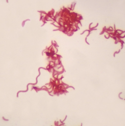 [294054] Spirillum gramnegativo, pieza completa Portaobjetos de microscopio para tinción de Gram negativa