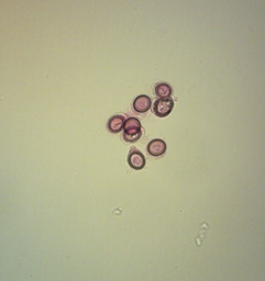 [306670] Portaobjetos de microscopio con una cantidad completa de huevos de Echinococcus granulosus
